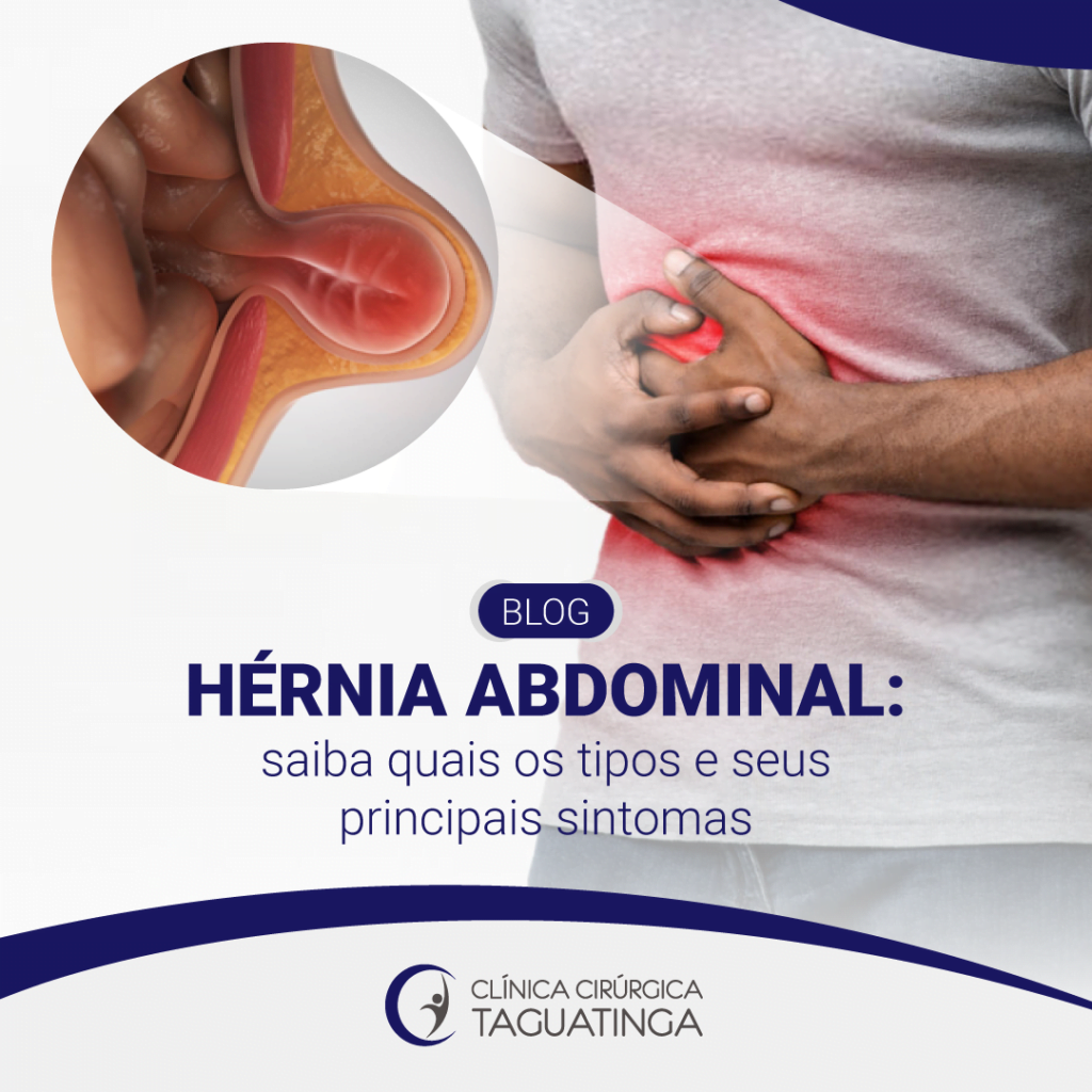 Hérnia abdominal: saiba quais os tipos e seus principais sintomas - Clínica  Cirúrgica Taguatinga